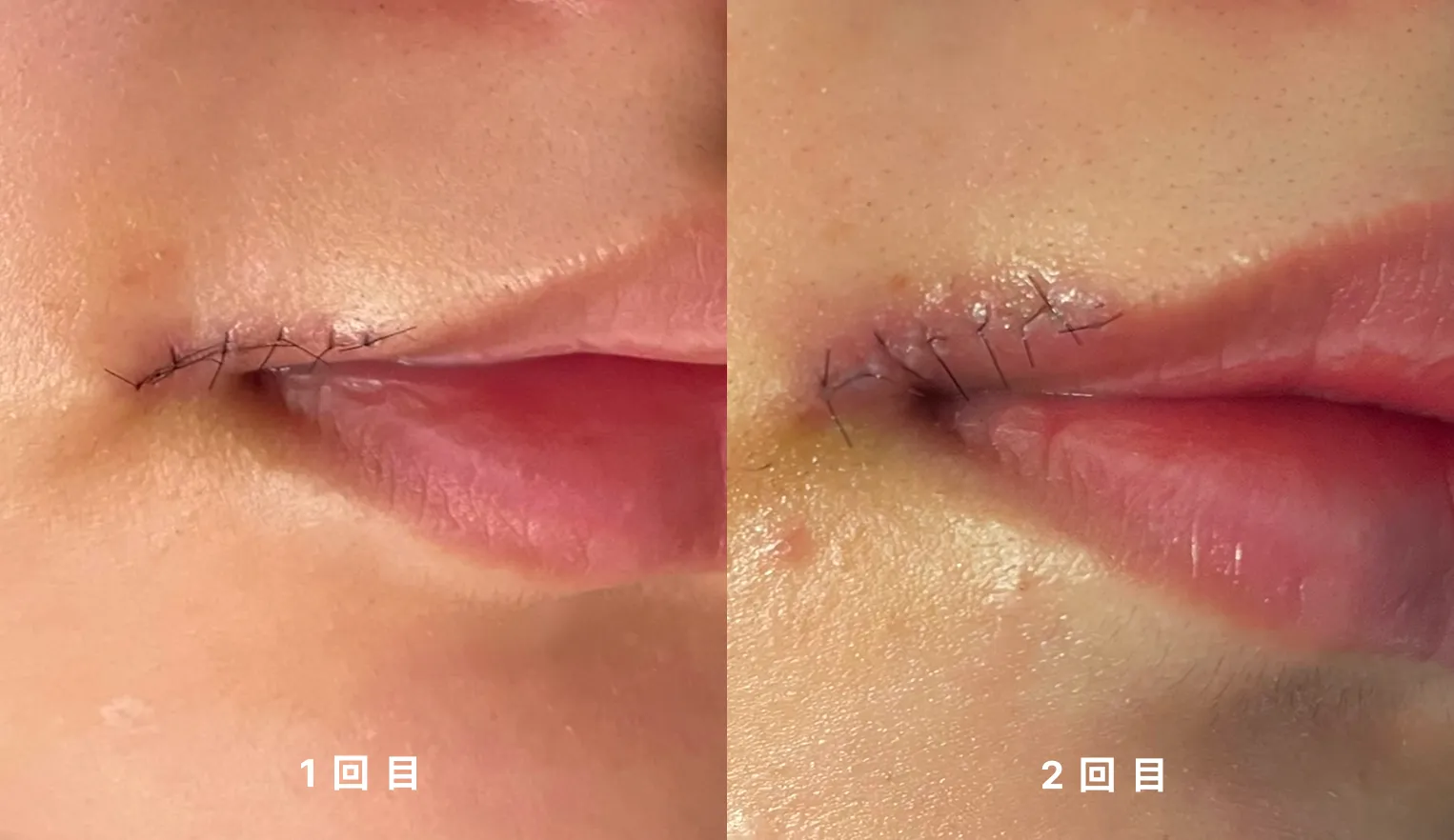 少しでも怪しいと思ったら、早めにCCTVの開示請求を !