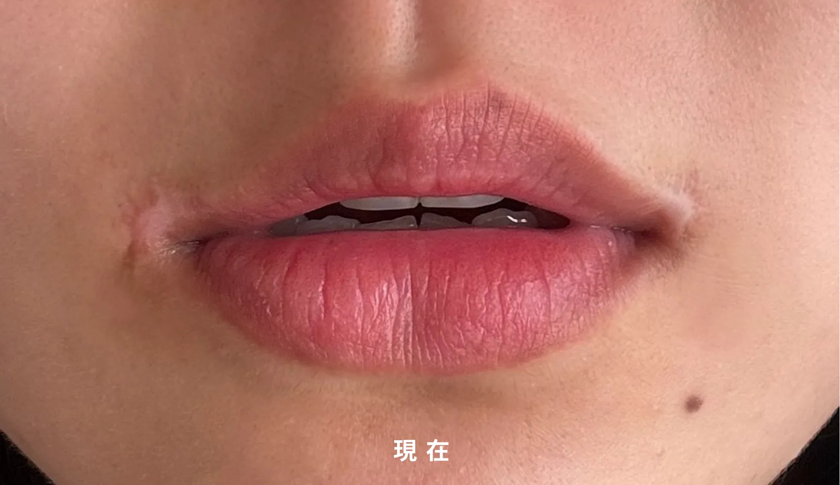 今回のことで私が必要だと思ったことを5つに厳選 !